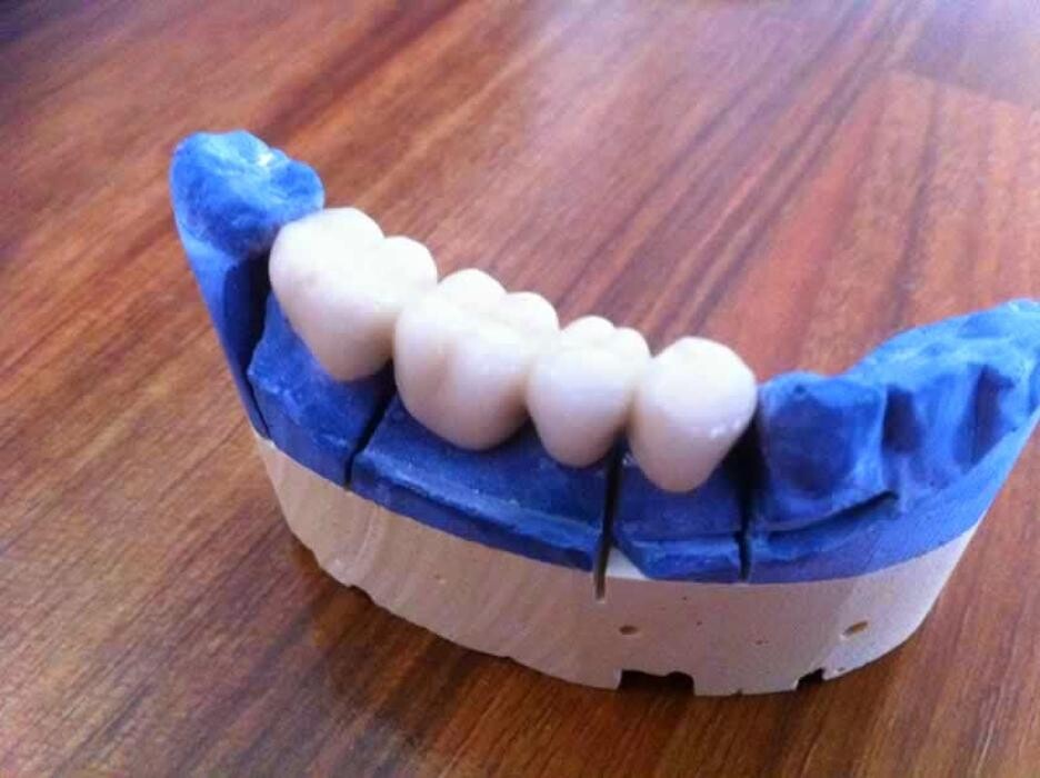 Images National Dental Care Strathfieldsaye