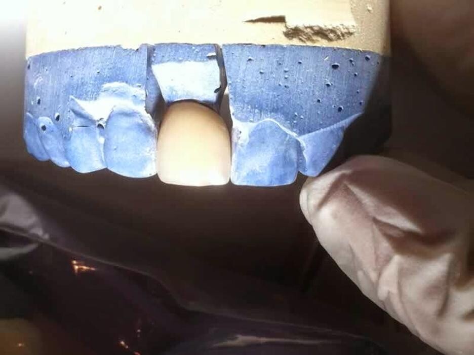 Images National Dental Care Strathfieldsaye