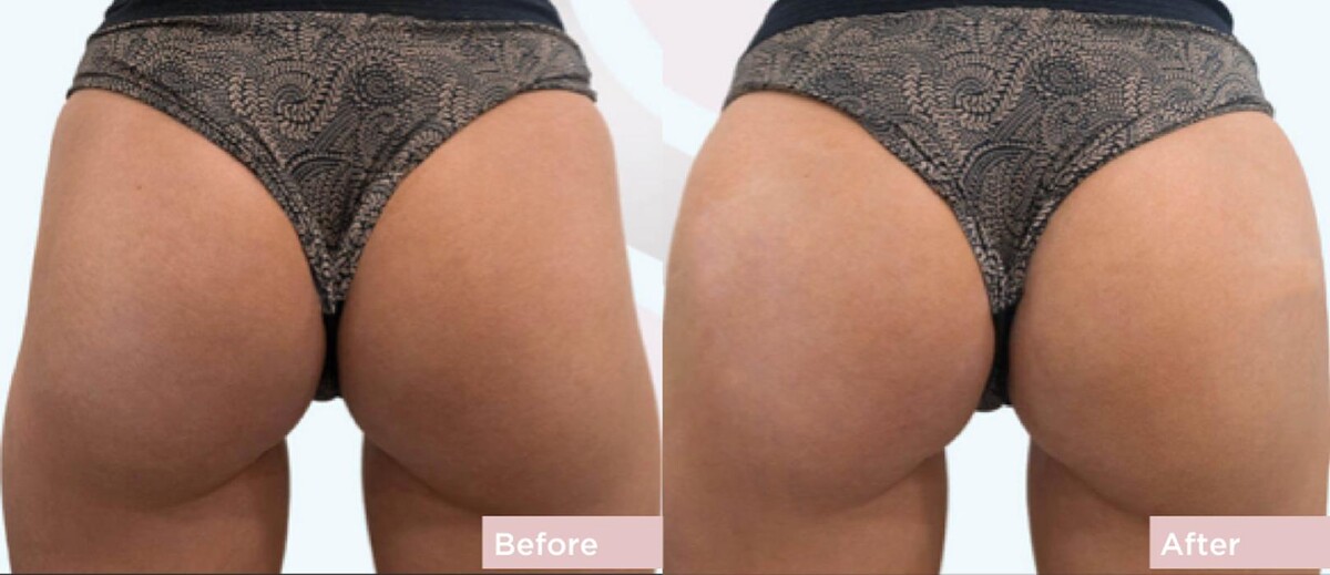 Images Contour Clinics Miranda
