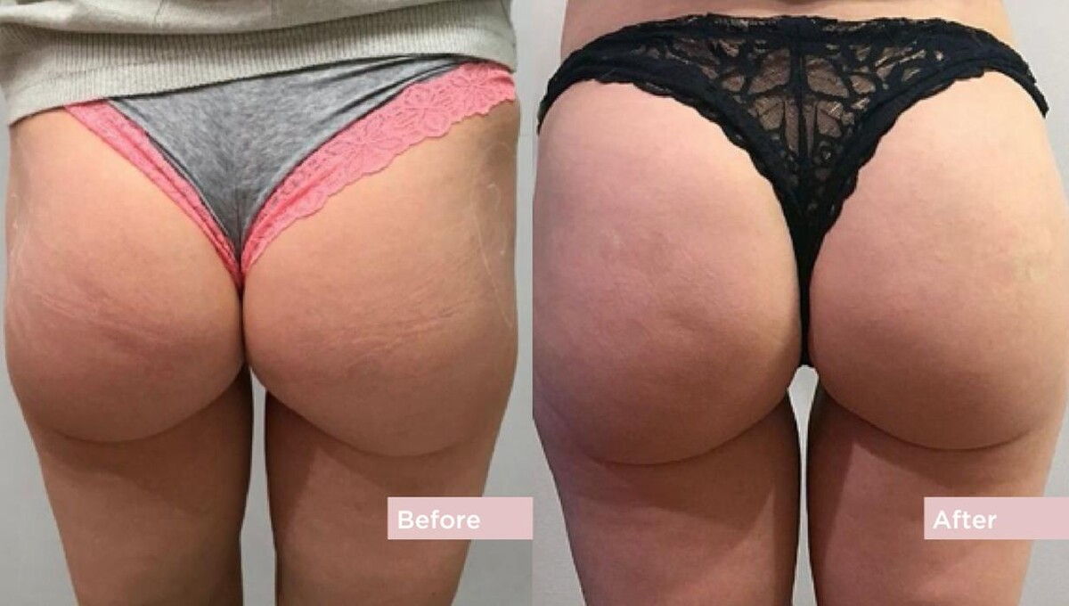 Images Contour Clinics Five Dock