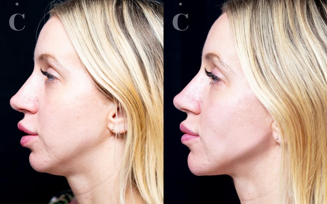 Images Contour Clinics Five Dock