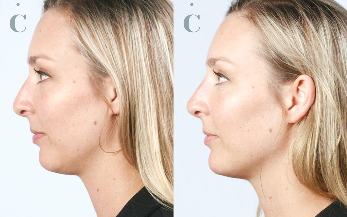 Images Contour Clinics Five Dock