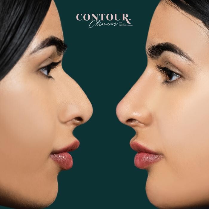 Images Contour Clinics Brisbane