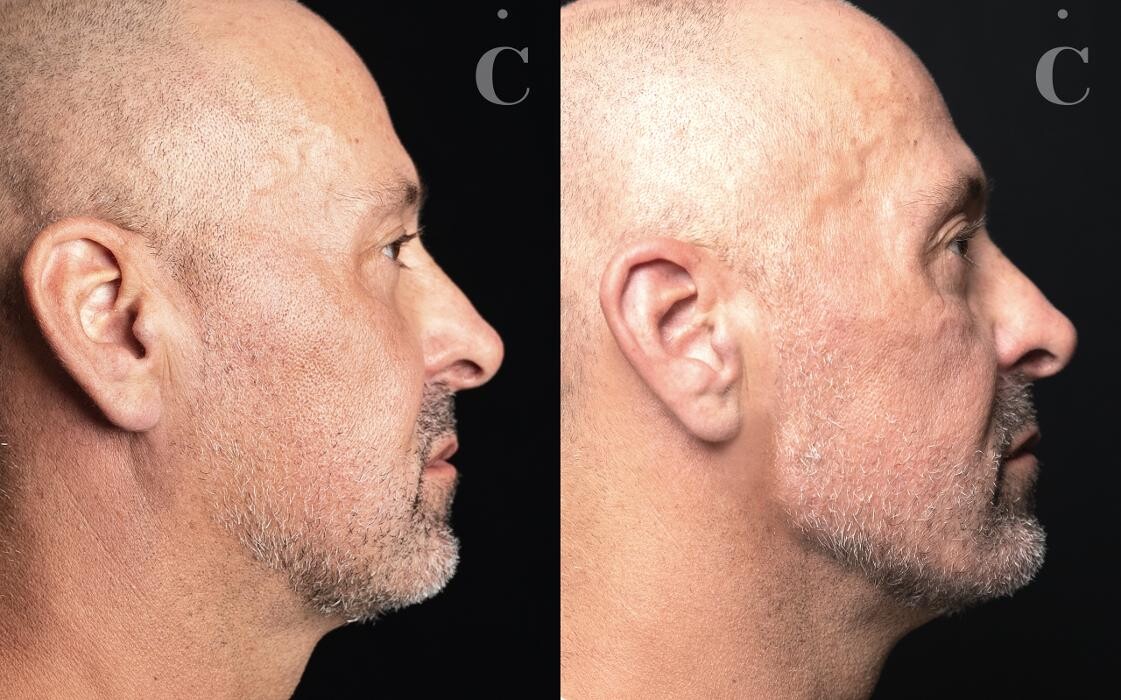 Images Contour Clinics Brisbane