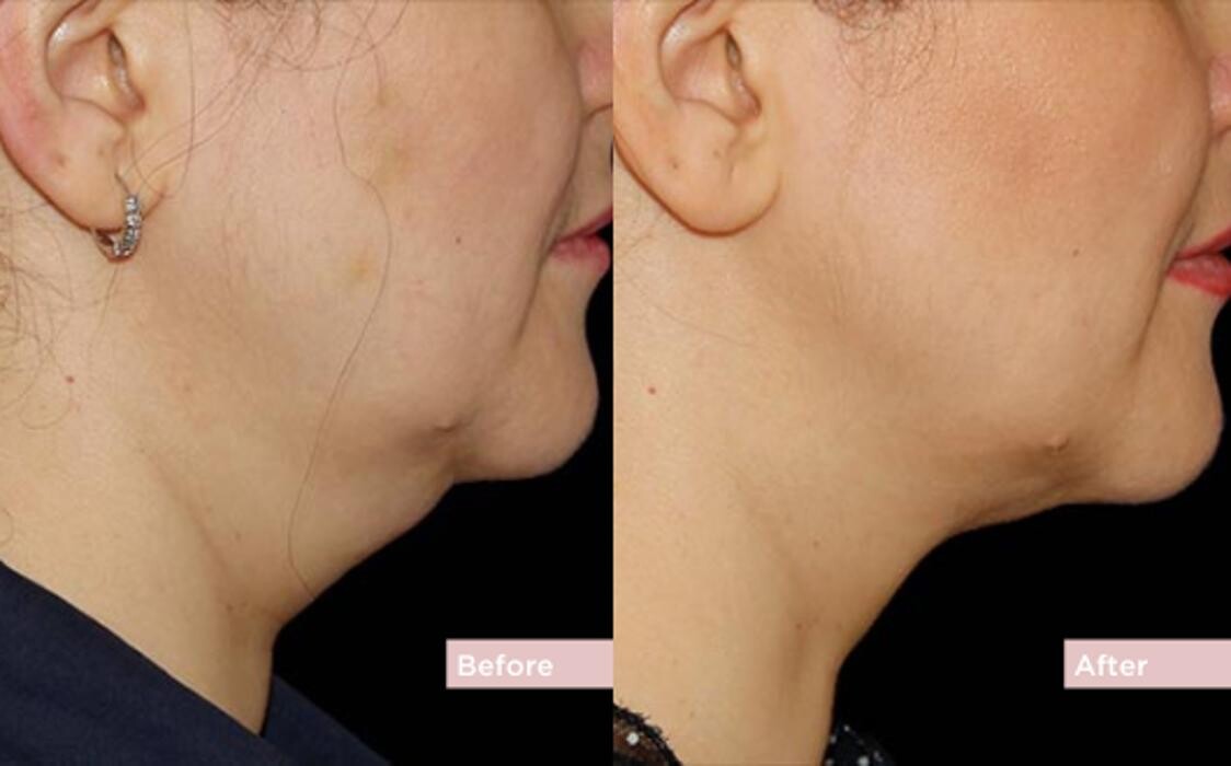 Images Contour Clinics Brisbane
