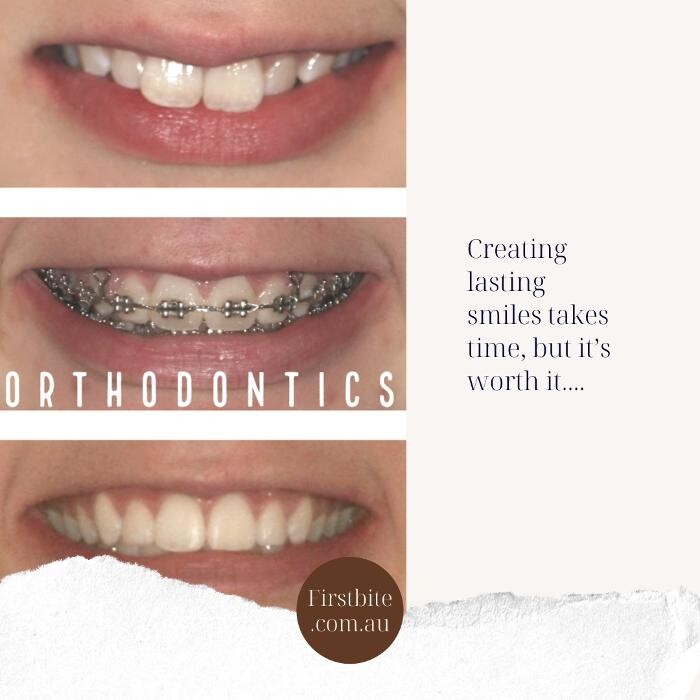 Images FirstBite Dental Essendon