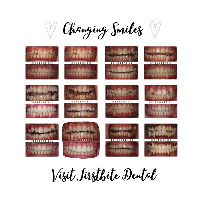 Images FirstBite Dental Essendon