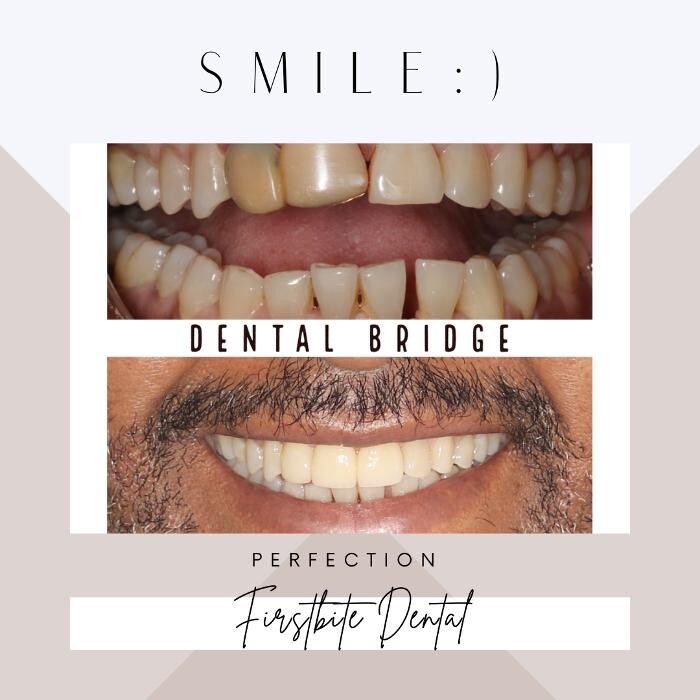 Images FirstBite Dental Essendon