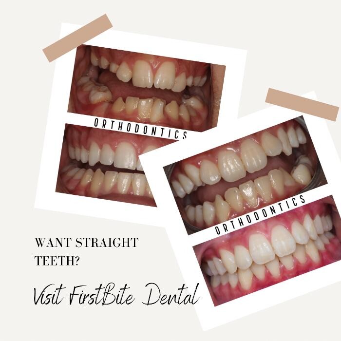 Images FirstBite Dental Essendon
