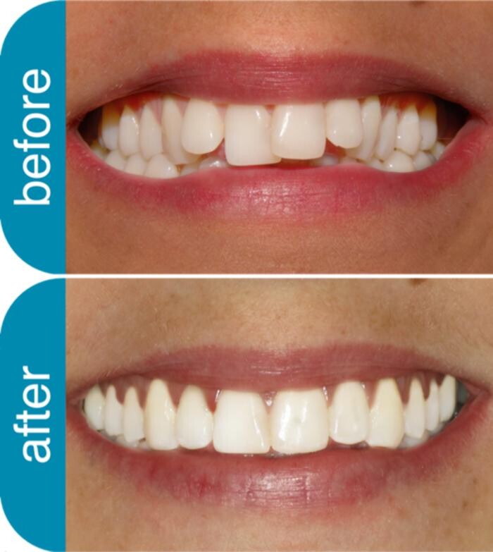 Images Metro Dental