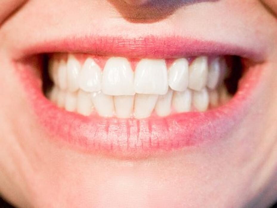 Images Metro Dental