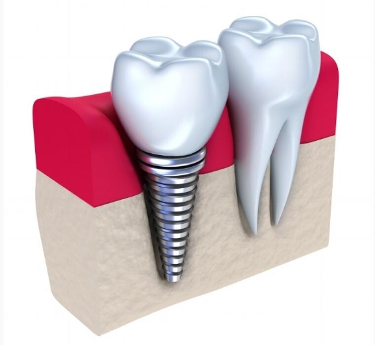 Images Metro Dental