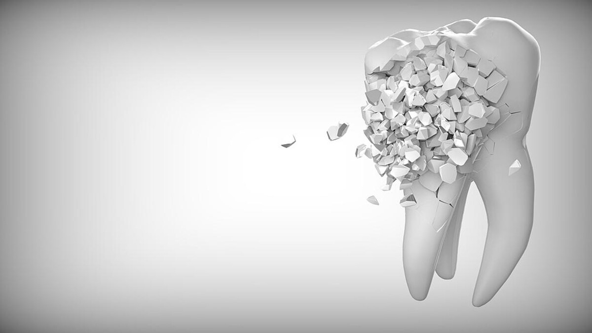 Images Metro Dental