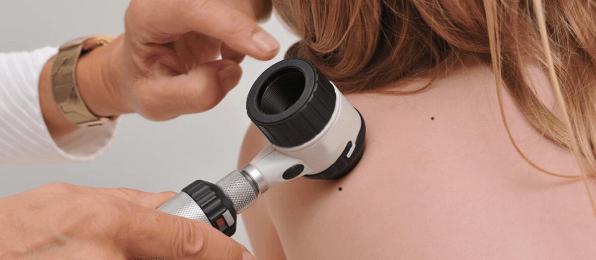 Images SunDoctors Skin Cancer Clinics Ryde