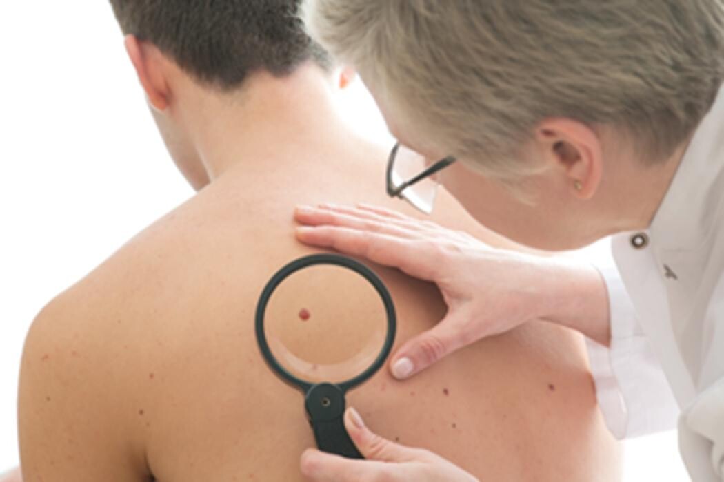Images SunDoctors Skin Cancer Clinics Ryde