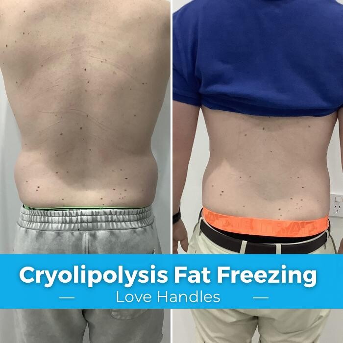 Images Elite Body Contouring Hurstville