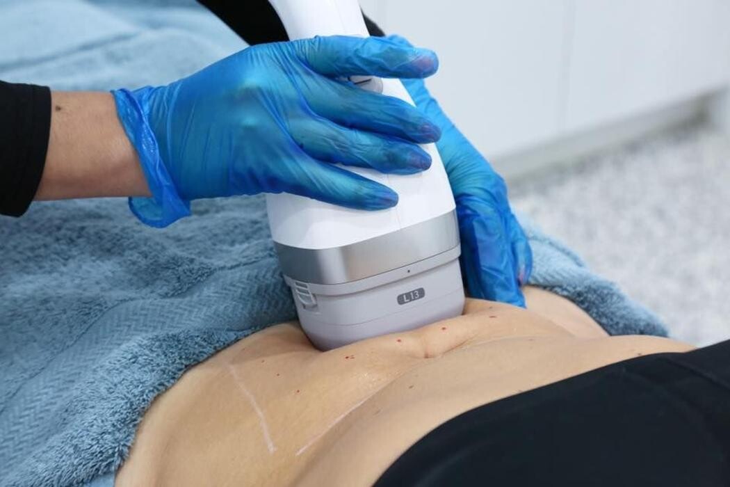 Images Elite Body Contouring Rosebery