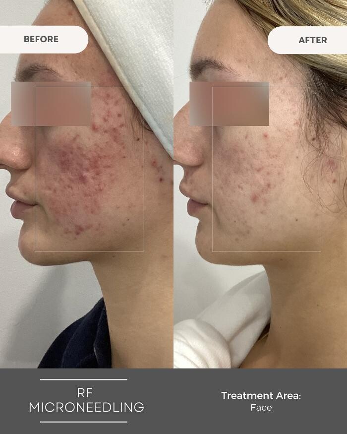 Images Elite Body Contouring Miranda