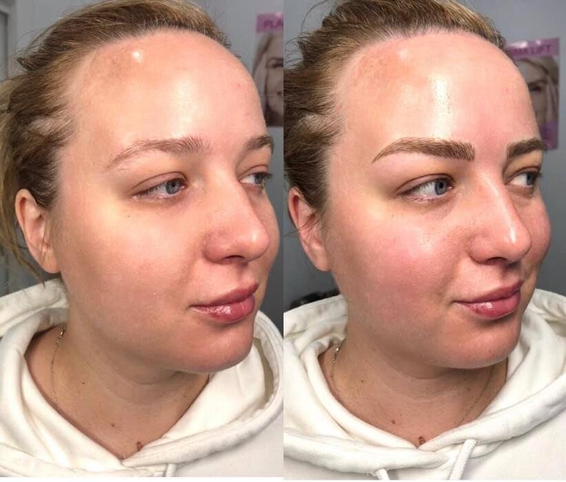 Images Alexia Rocha Aesthetics - Cosmetic Tattoo Adelaide