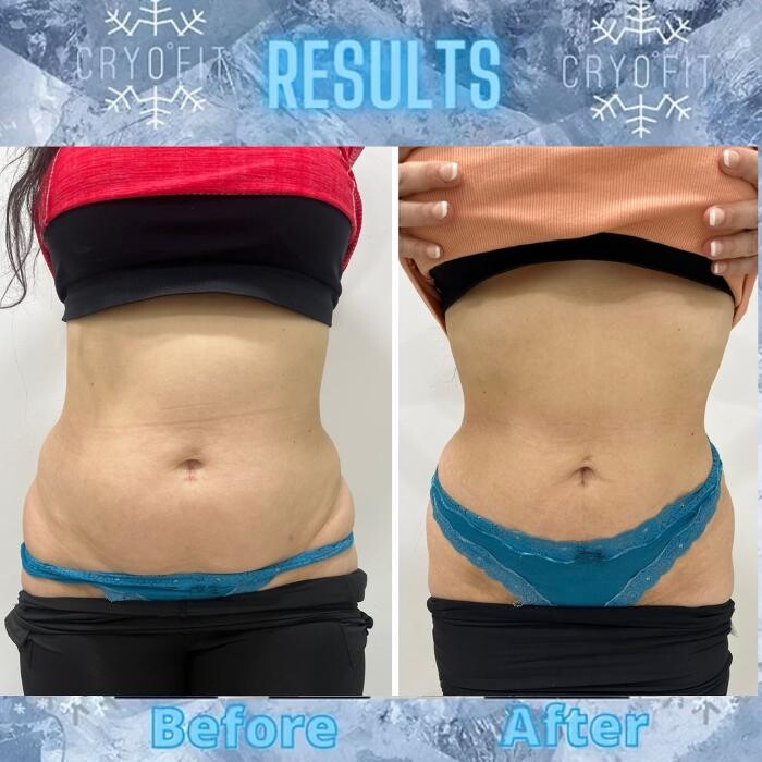 Images Alexia Rocha Aesthetics - Cosmetic Tattoo Adelaide