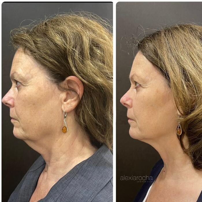 Images Alexia Rocha Aesthetics - Cosmetic Tattoo Adelaide