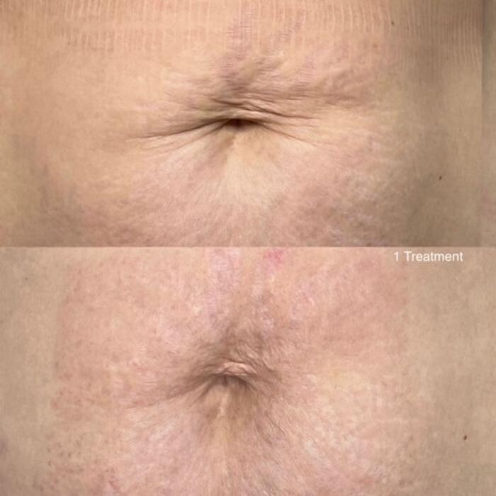 Images Alexia Rocha Aesthetics - Cosmetic Tattoo Adelaide