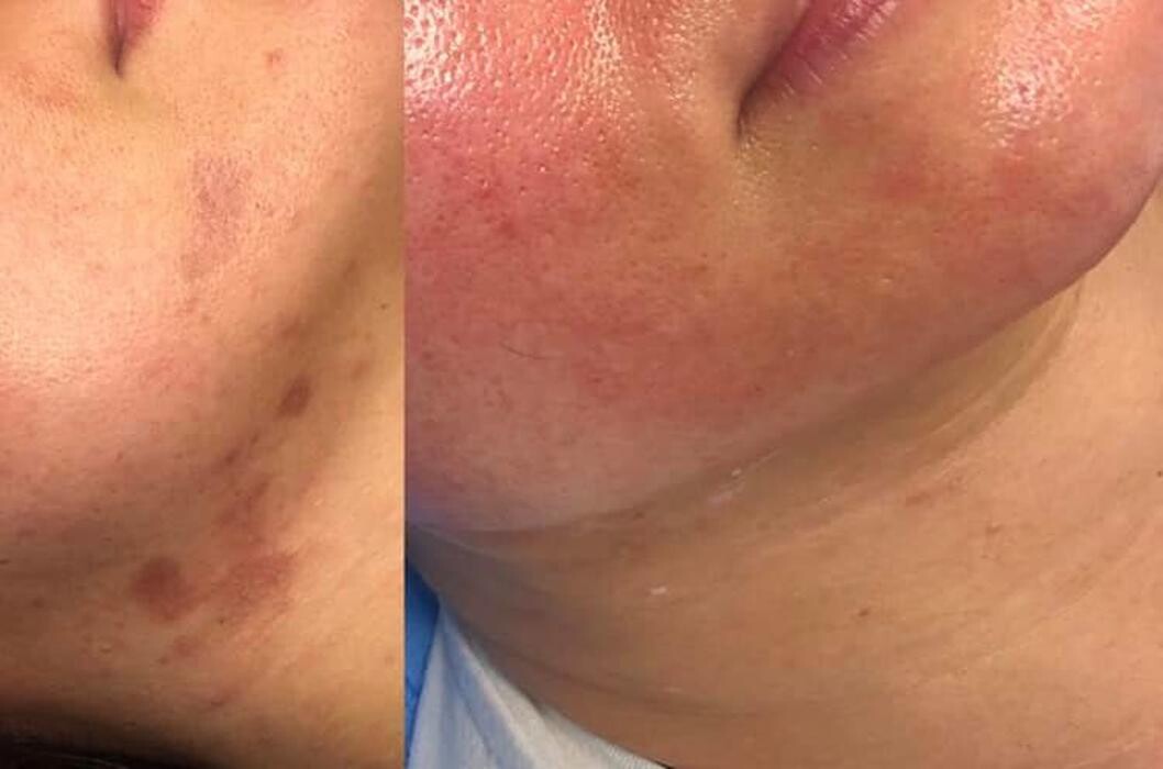 Images Alexia Rocha Aesthetics - Cosmetic Tattoo Adelaide