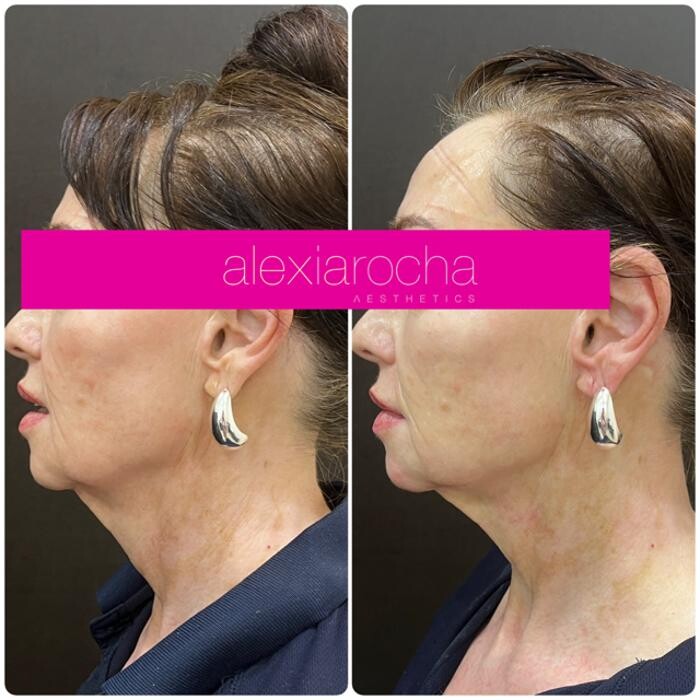 Images Alexia Rocha Aesthetics - Cosmetic Tattoo Adelaide