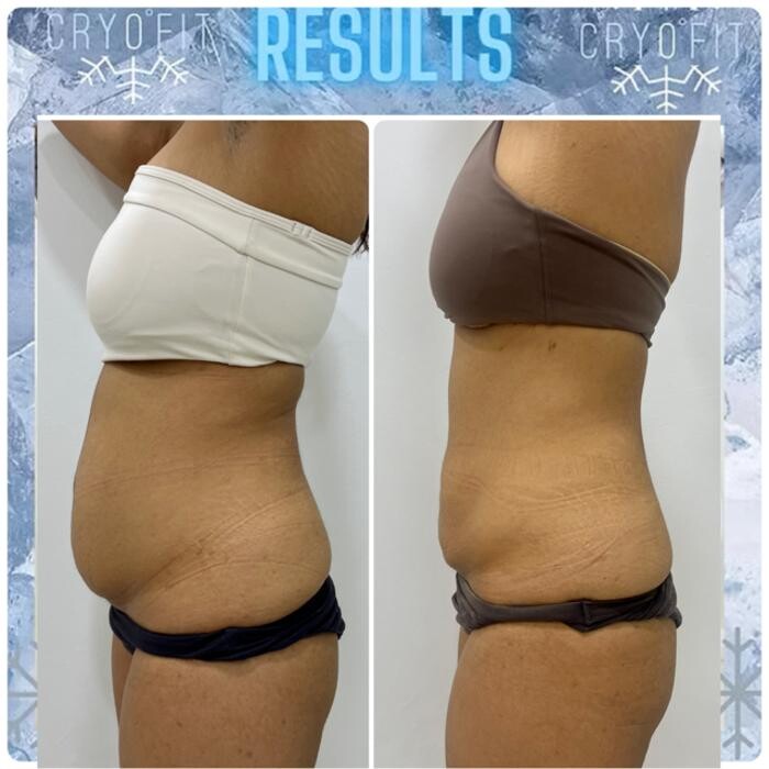 Images Alexia Rocha Aesthetics - Cosmetic Tattoo Adelaide