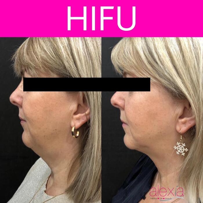 Images Alexia Rocha Aesthetics - Cosmetic Tattoo Adelaide