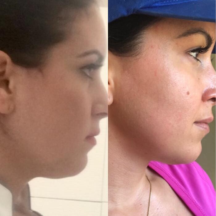 Images Alexia Rocha Aesthetics - Cosmetic Tattoo Adelaide