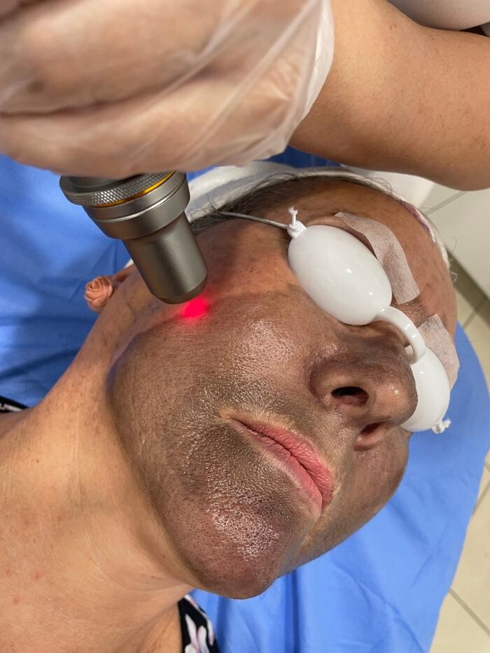 Images Alexia Rocha Aesthetics - Cosmetic Tattoo Adelaide