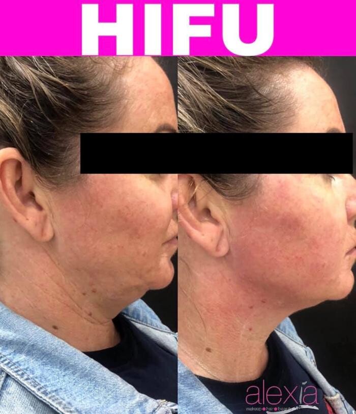 Images Alexia Rocha Aesthetics - Cosmetic Tattoo Adelaide