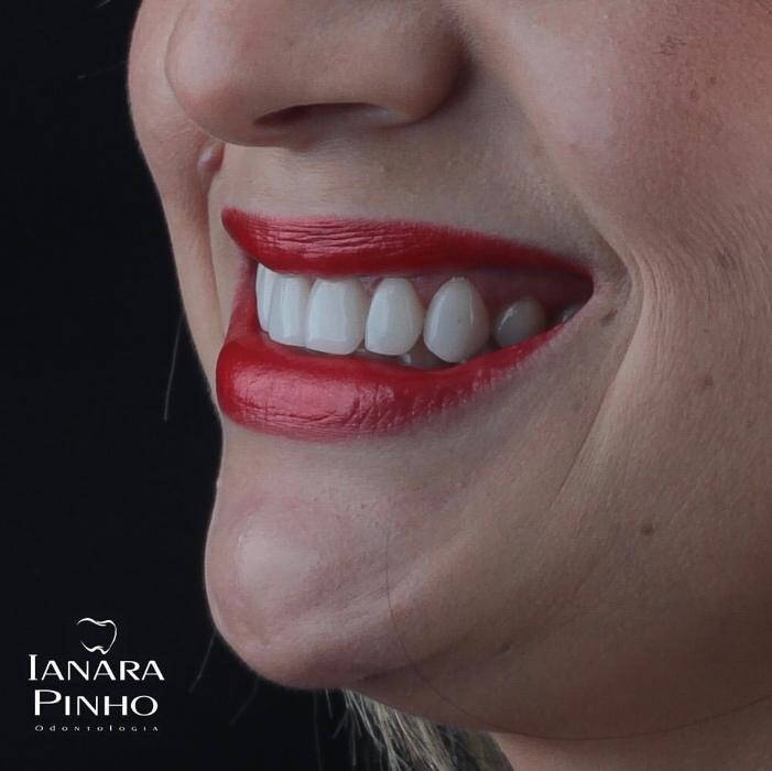 Images Ianara Pinho Odontologia