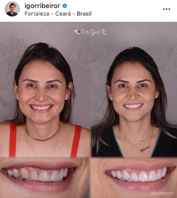 Images Dr. Igor Ribeiro | Harmonização Facial & Lentes dentais em Fortaleza | Botox | Clínica de Estética