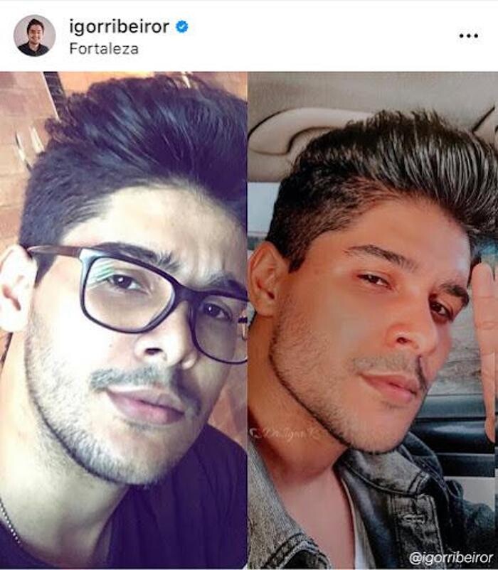 Images Dr. Igor Ribeiro | Harmonização Facial & Lentes dentais em Fortaleza | Botox | Clínica de Estética