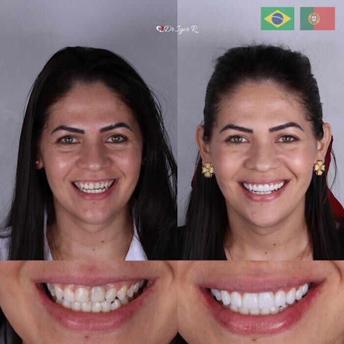 Images Dr. Igor Ribeiro | Harmonização Facial & Lentes dentais em Fortaleza | Botox | Clínica de Estética