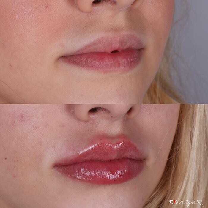 Images Dr. Igor Ribeiro | Harmonização Facial & Lentes dentais em Fortaleza | Botox | Clínica de Estética