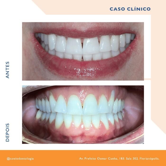 Images COEI Clinica Odontológica | Dentista em Florianópolis