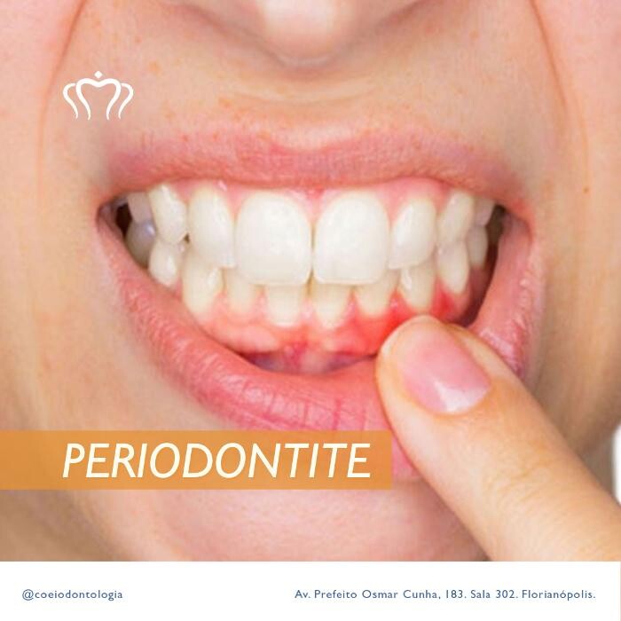 Images COEI Clinica Odontológica | Dentista em Florianópolis