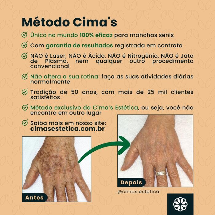 Images Cima´s Estética - Remoção de Manchas Senis em São Lourenço