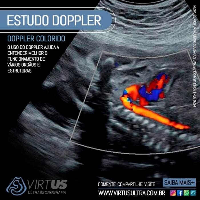 Images CLÍNICA VIRTUS - Ultrassonografia