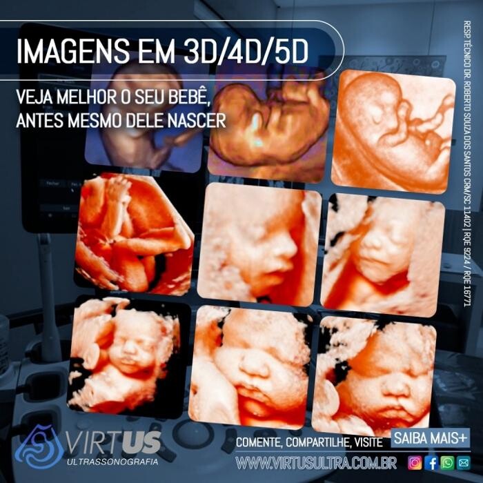 Images CLÍNICA VIRTUS - Ultrassonografia