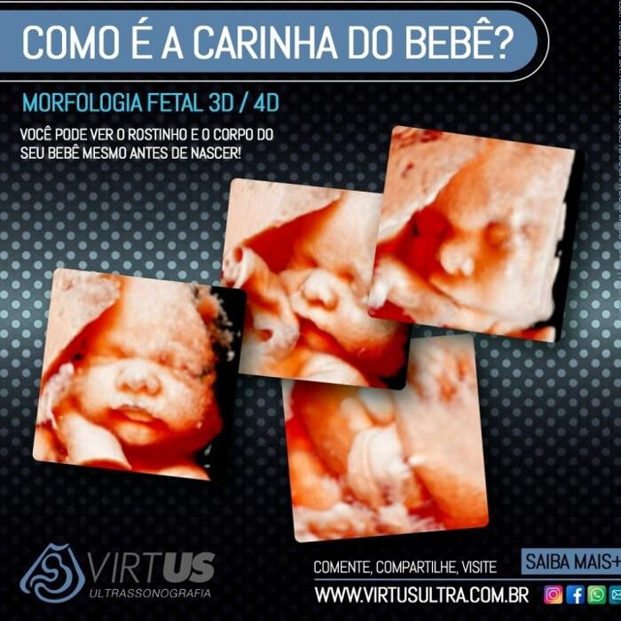 Images CLÍNICA VIRTUS - Ultrassonografia