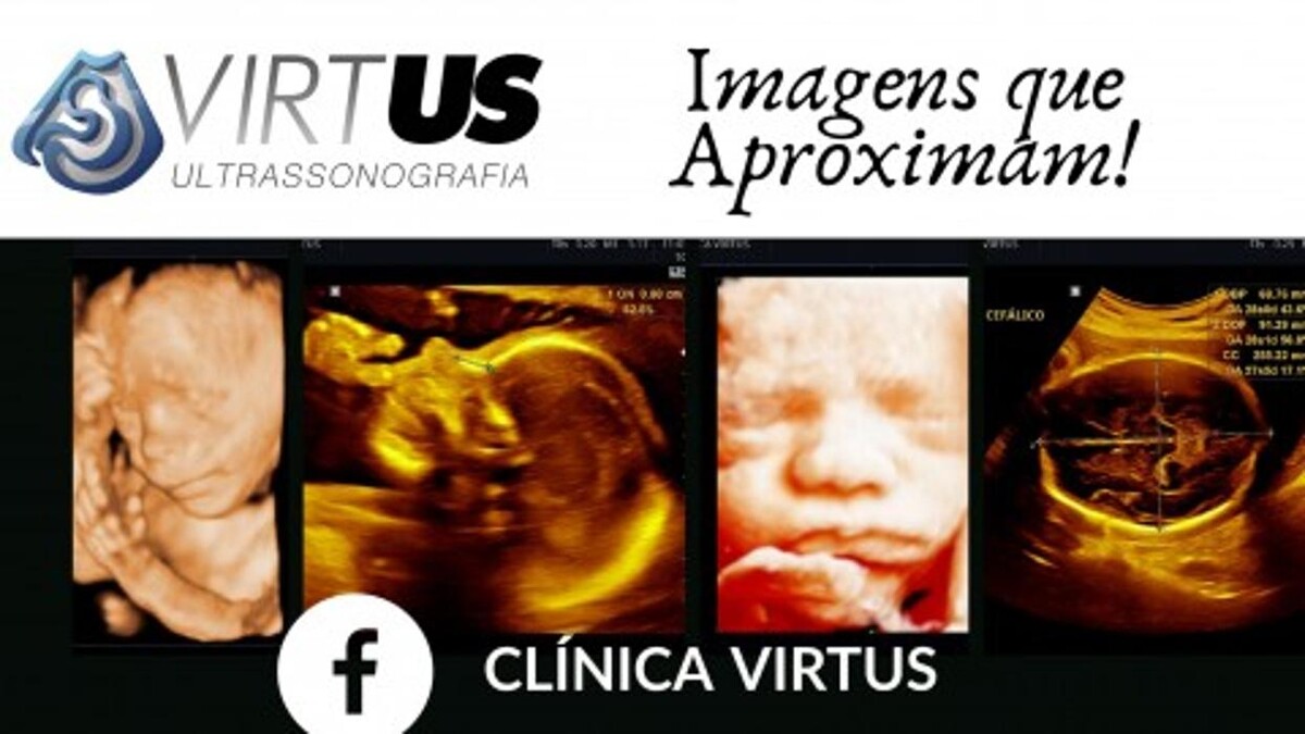 Images CLÍNICA VIRTUS - Ultrassonografia