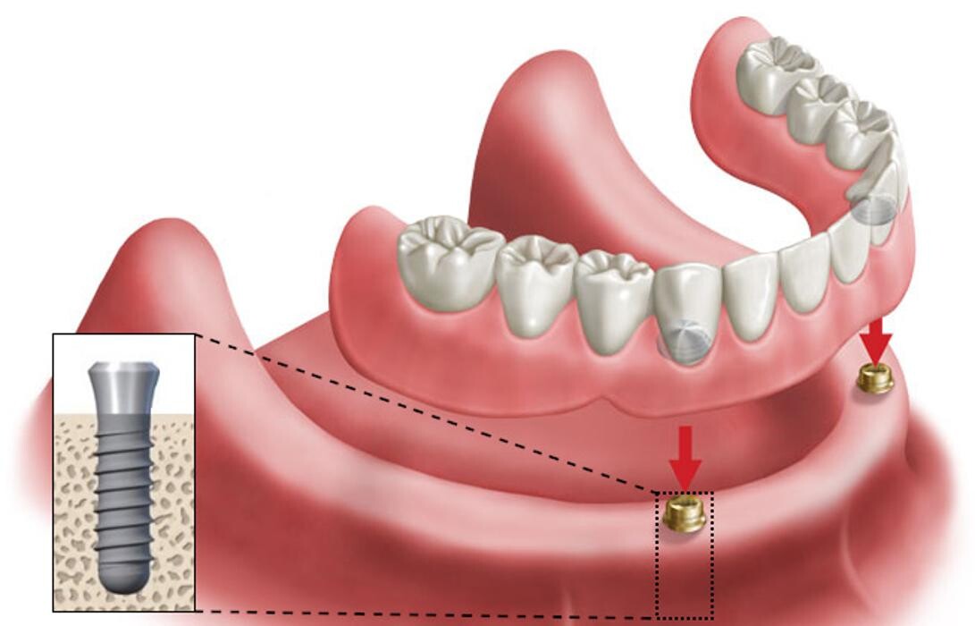 Images Tim Schankula Denture Clinic