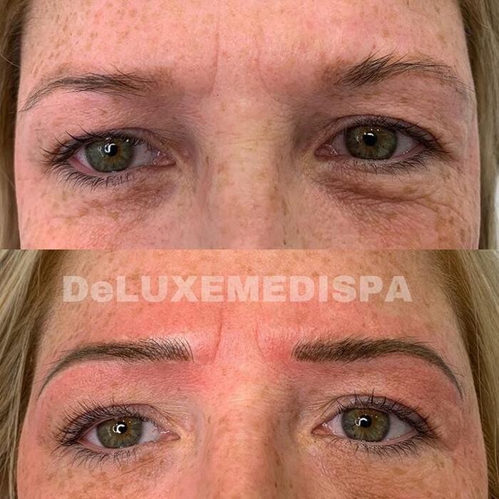 Images Deluxe Medispa - New Tecumseth Laser Skin Clinic