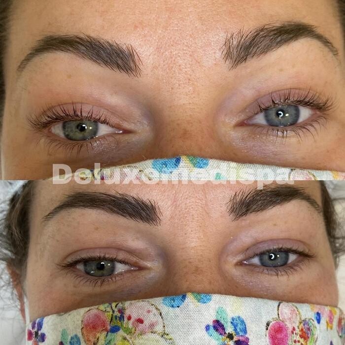 Images Deluxe Medispa - New Tecumseth Laser Skin Clinic