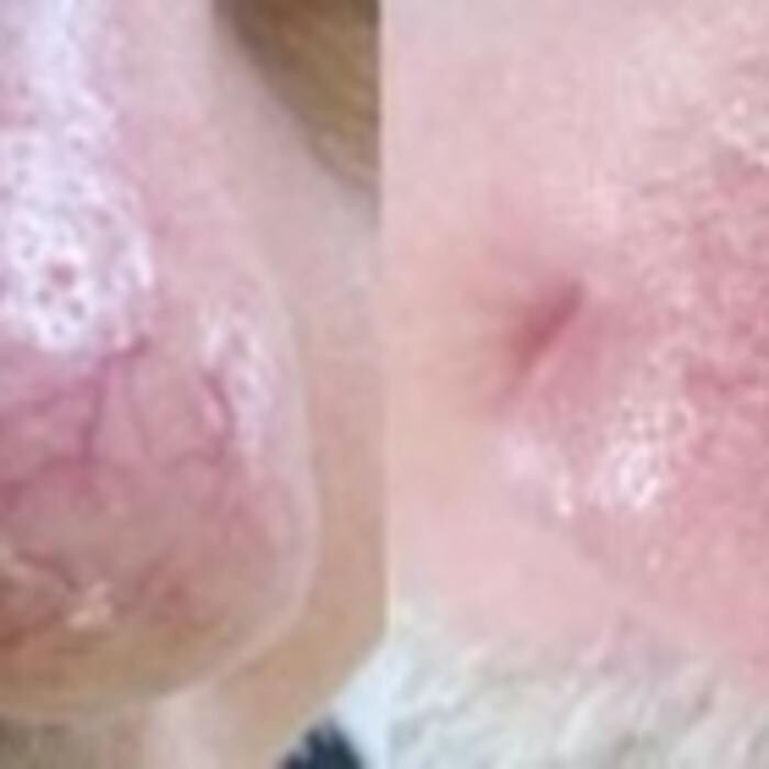Images Nell Laser Clinic
