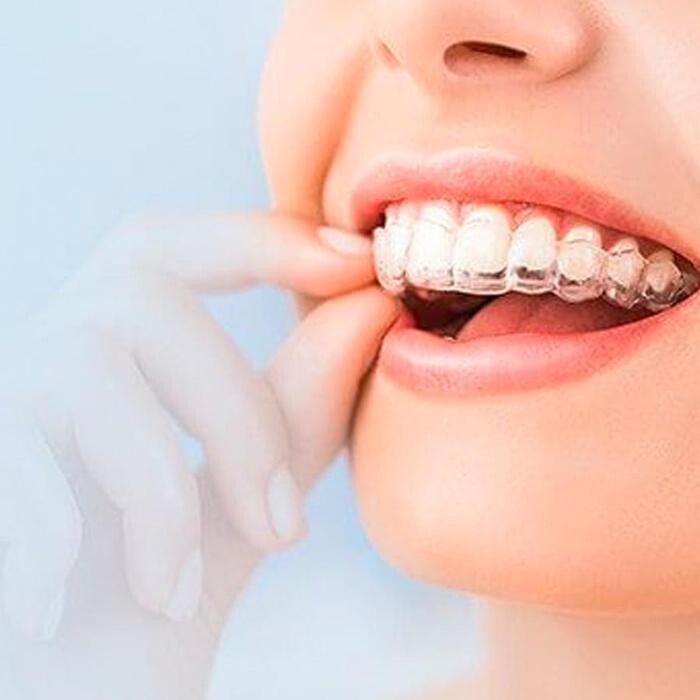 Images Smiley Dental